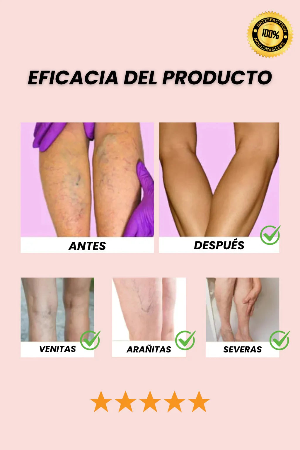 Spray Venofix™: El secreto para Piernas Ligeras, Lisas y Sin Venitas Visibles.