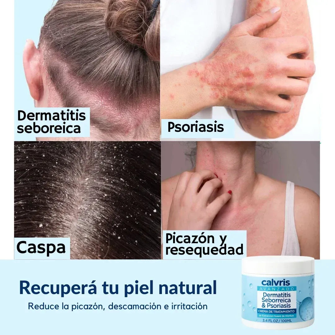 Calvris - El Bálsamo de Rescate Natural que Tu Piel Pide a Gritos