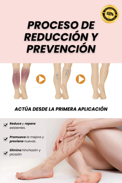 Spray Venofix™: El secreto para Piernas Ligeras, Lisas y Sin Venitas Visibles.